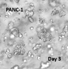ヒト膵臓がん細胞（PANC-1）の3D培養